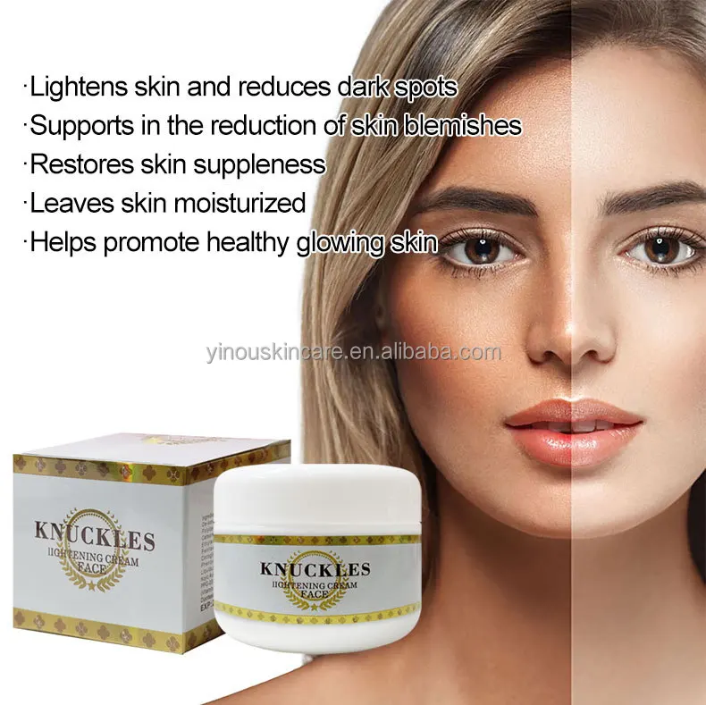 Private Label Knuckles And Toes Elbow Joints And Knees Whitening Dark Spot Removal Cream Whiting Lotion For Black Skin