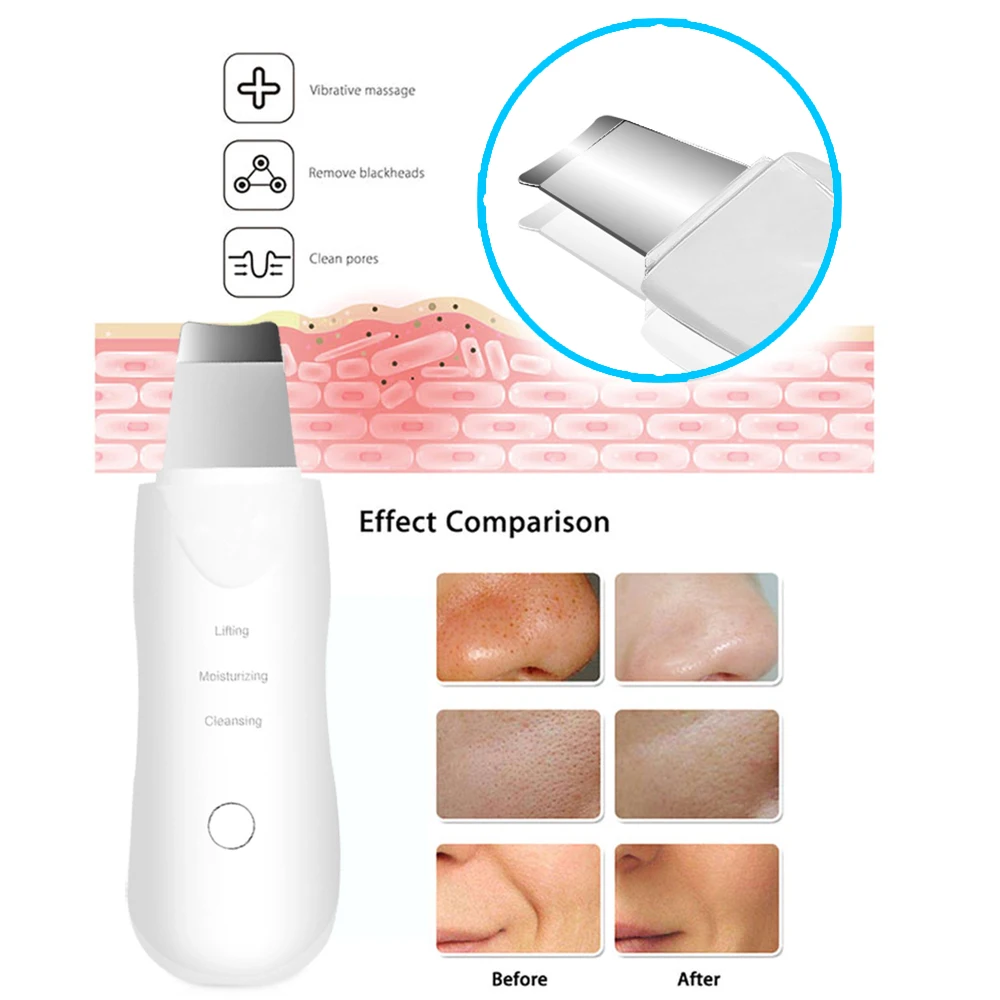 
Rechargeable Not Ultrasonic Skin Scrubber Vibration Massage Deep Facial Cleaning Remove Dirt Blackhead Face Skin Care Device 
