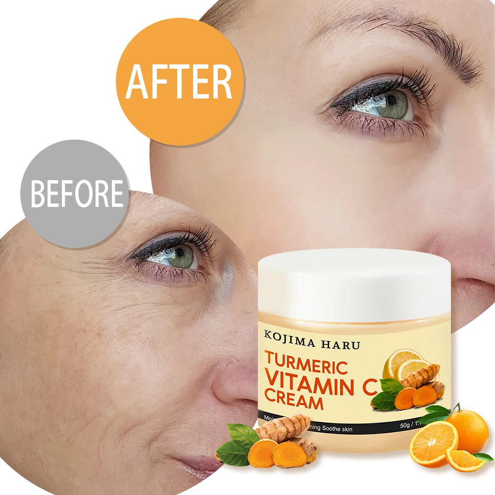Private label Turmeric retinol beauty whitening face cream kojic acid glowing skin face cream for dry skin for women