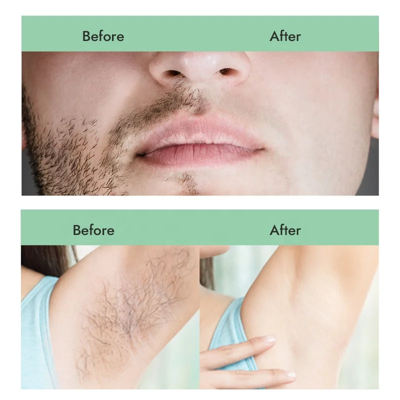 Waxkiss Soft Medium Hard Consistency Water soluble Sugar Wax Hair Removal Sugaring Paste For Sensitive Skin