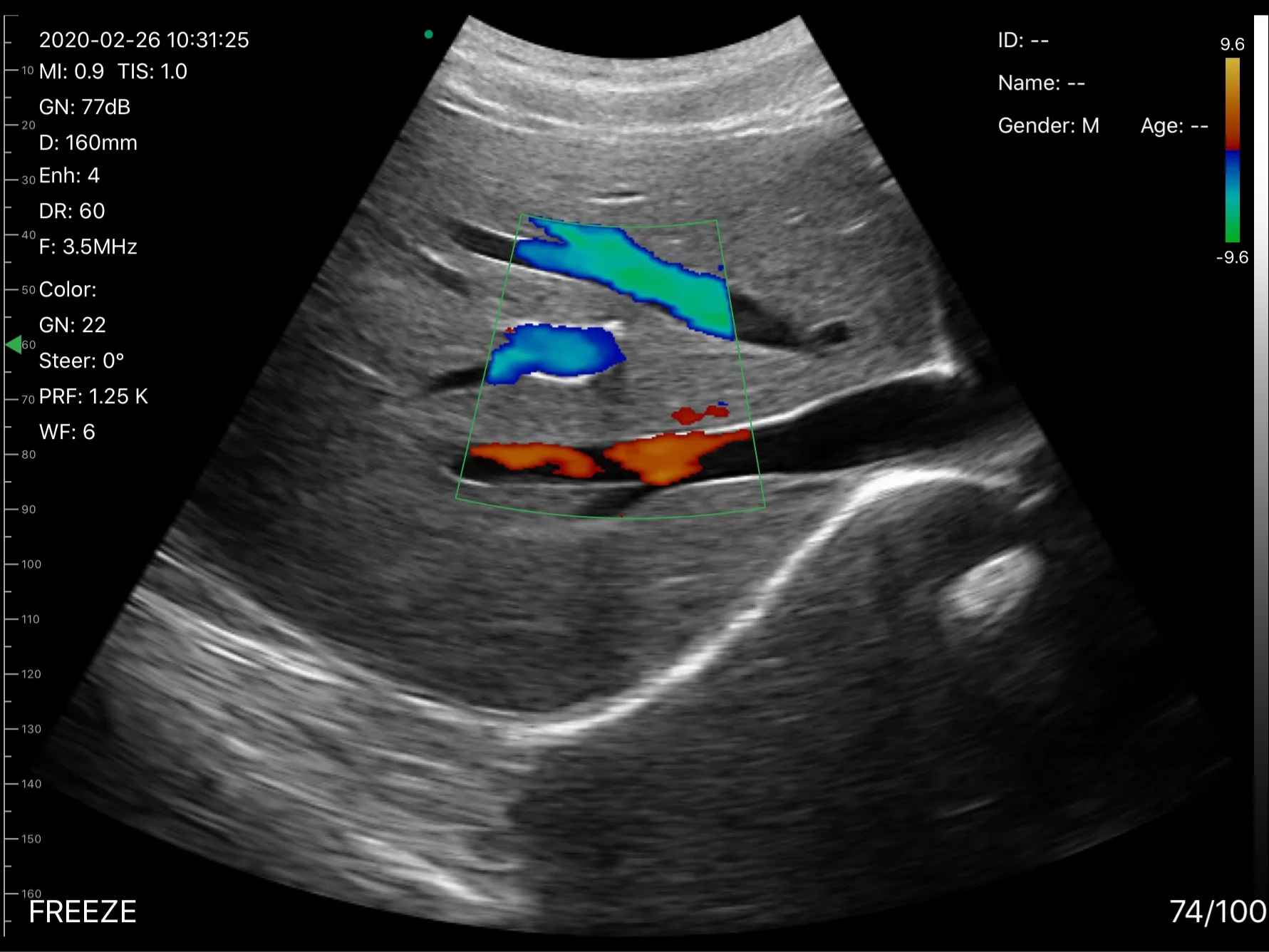 High Quality Double Head Ultrasound Convex and Linear Probe for Sale / Handheld Ultrasound Scanner Price