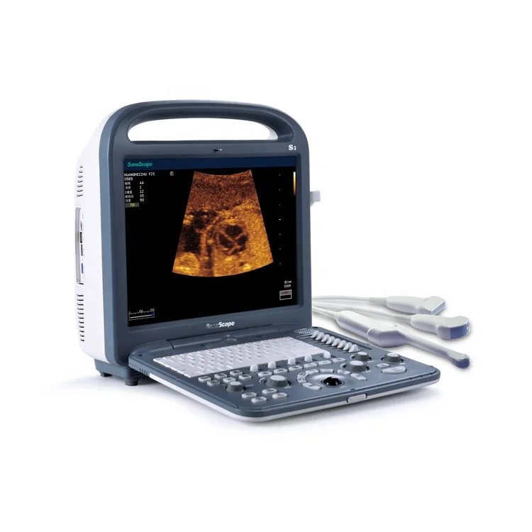 
 Sonoscape s2 medical ultrasound instruments/color doppler  