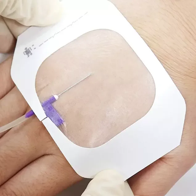 Disposable Waterproof Transparent IV Dressing IV Cannula Dressing medical dressing
