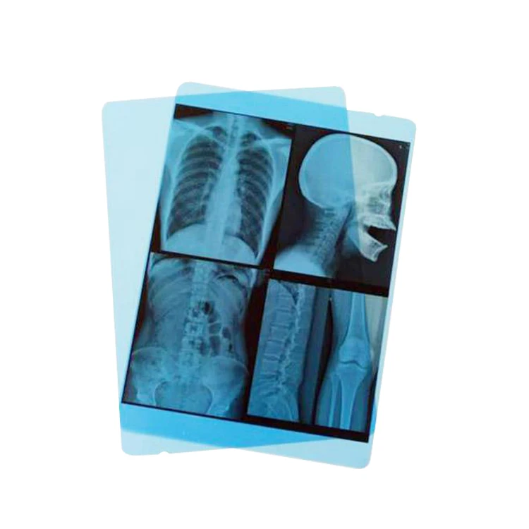 Waterproof PET Base Material Medical 210um Blue Inkjet XRay Film Manufacture