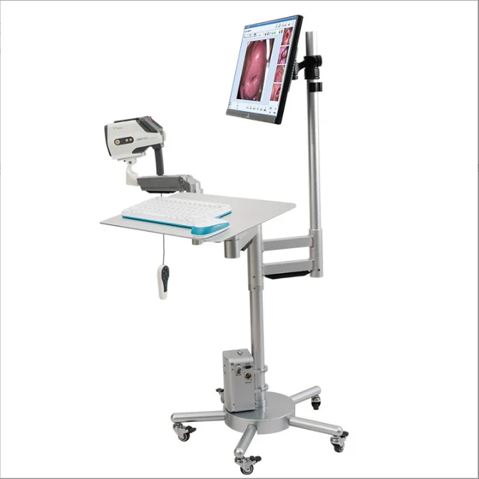 Hospital Gynecology Equipment Digital Beautiful Vagina Self Exam Mini Hd Colposcope Camera