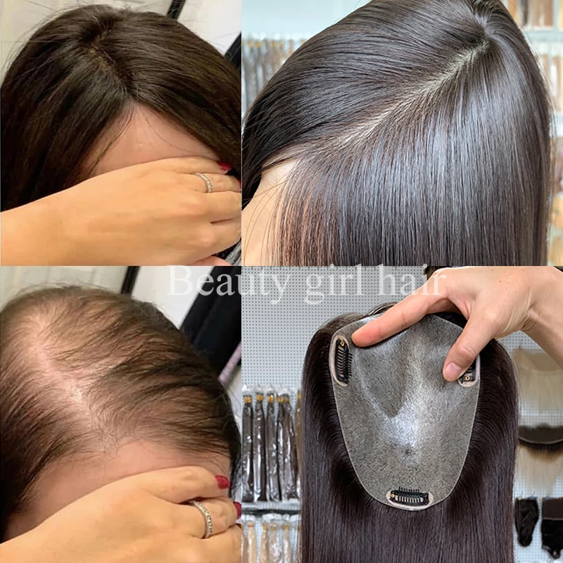 Alternative Hair Virgin Remy Silk Hair Toppers For Women Human Hair Side Topper Polyeurathane Skin Toupee Base Supplier