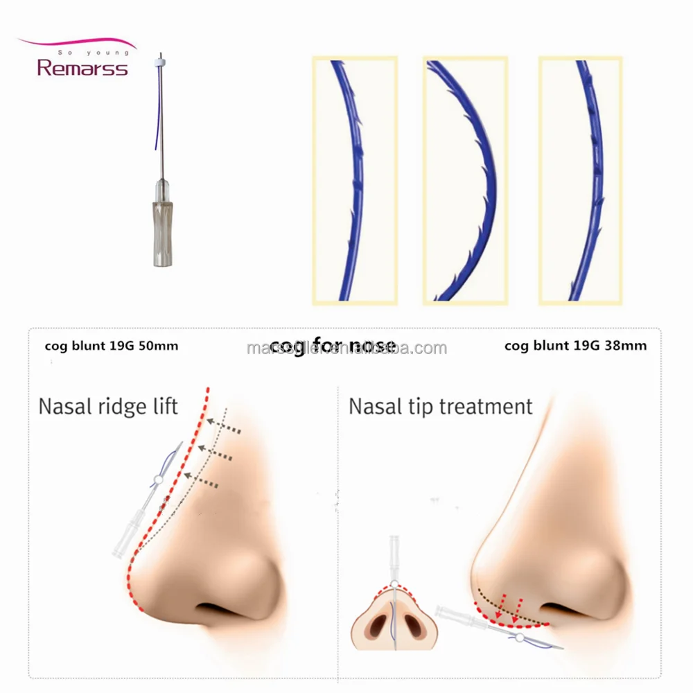 
2021 The Surface of Suture Materials Mono Blunt 30g 25mm Pdo Thread Eye Area Lift All kinds of models can be customized 