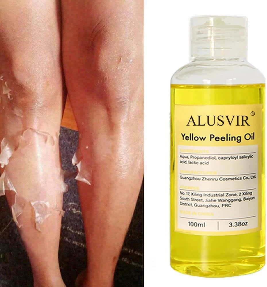 Private Label Yellow Peeling Oil Yellow Extra Strong Whitening  Exfoliating Bleaching Dark Skin Peeling Oil