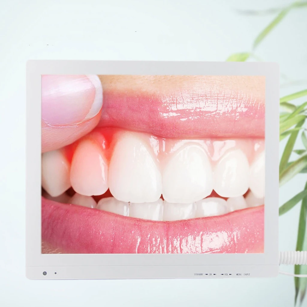 Handheld Dental Camera Oral Endoscope