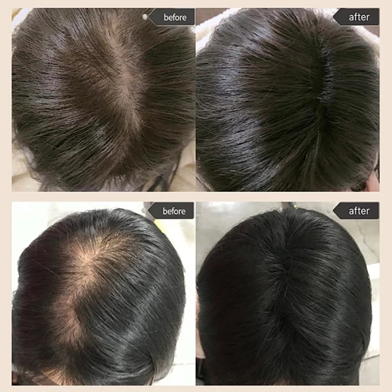 Private brand organic Polygonum multiflorum hair nourishing, anti-hair loss, hair growth shampoo, oil control and anti-dandruff