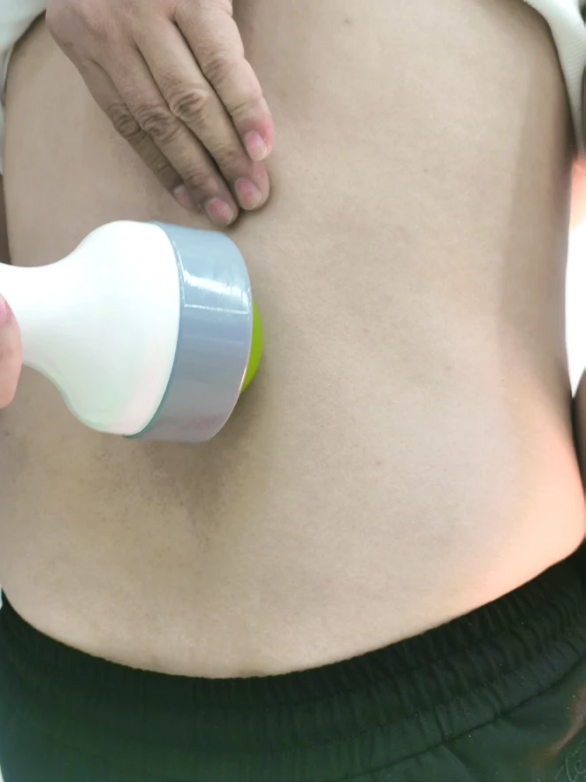 cheap focused focal extracorporeal erectile dysfunction shockwave therapy