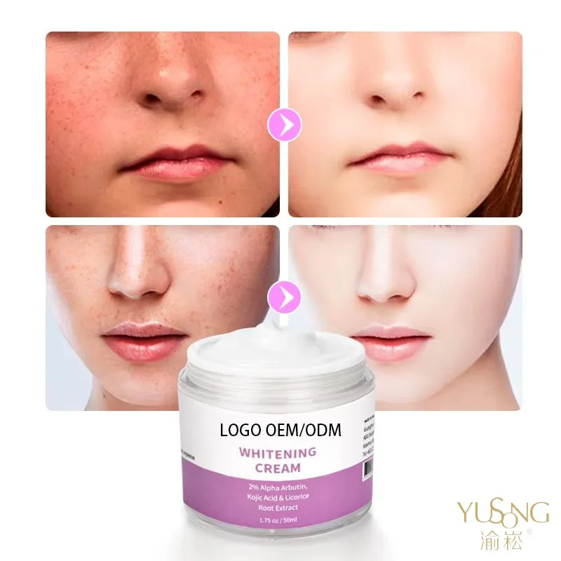 Korean Best Whitening Cream Day And Night Dark Knees And Elbows Strong Whitening Cream