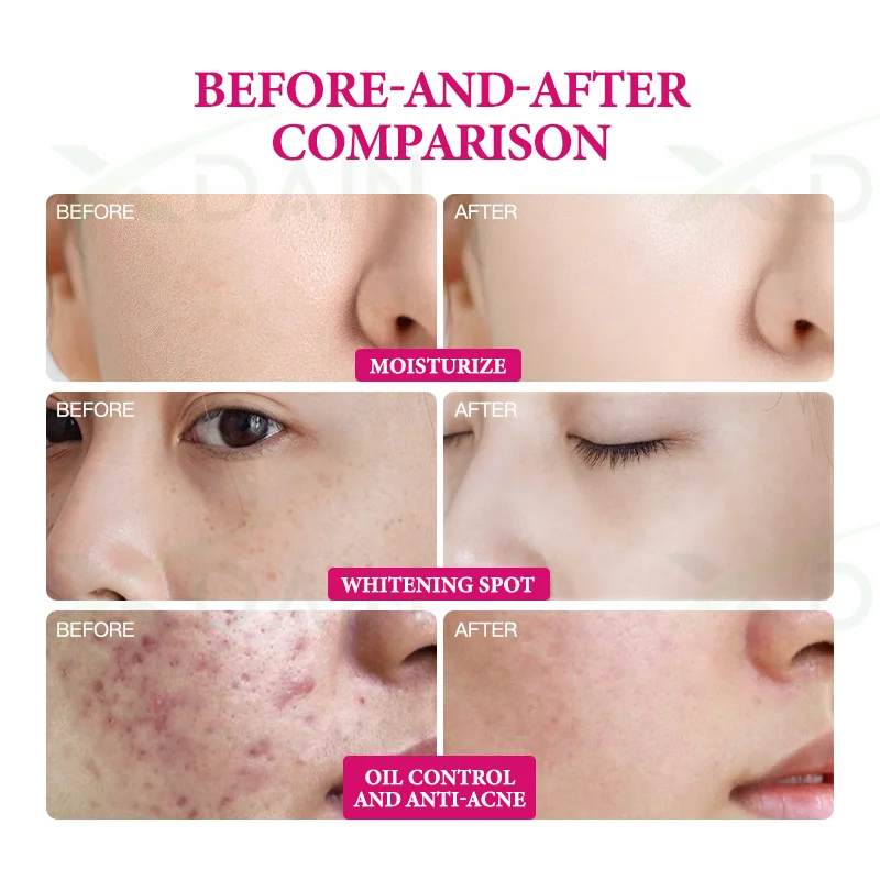 Custom Vitamin C Peptides Anti Aging Facial Cleanser Eye Mask Toner Serum Eye Cream Lotion Cream Lady Cream Gifts Sets For Women