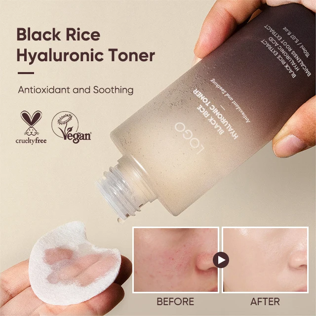 Organic Tonique Pour Le Visage Moisturizing Brightening Korean Face Black Rice Milk Toner Hyaluronic Skin Toner