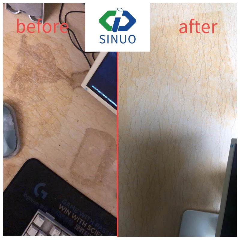 
Portable Obvious Effects Pigment Remover Stains Remover Chemical Cleanser 