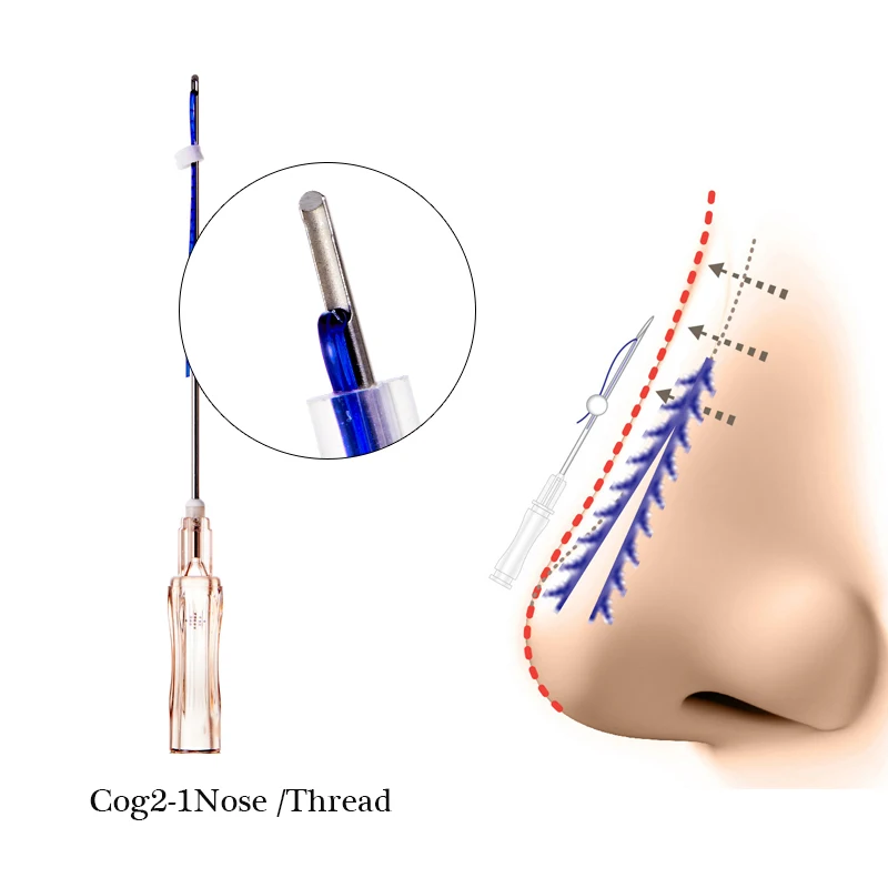 Korean supplier good price 19g38mm 19g 50mm 60mm nose absorbable pdo thread for nose lifting