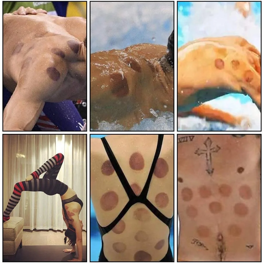 12 Cups Chinese Traditional Massage Vacuum Cupping Therapy Set Plastic Cupping Cups For Pain Relief