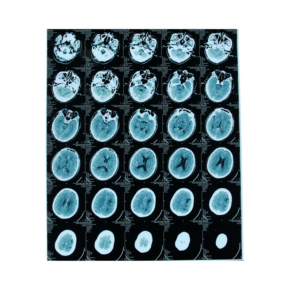 
Wholesale price Fiji digital x ray film carestream film radiology equipment x-ray film 