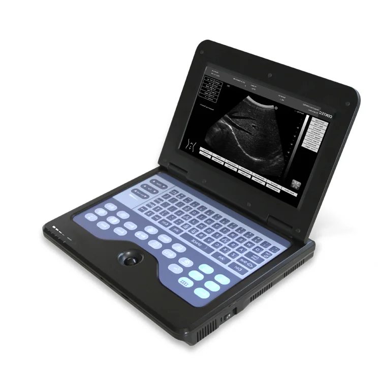 CE cheapest portable ultrasound portable ultrasonic scanner