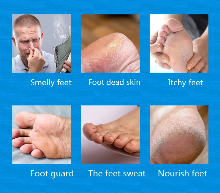 Foot Skin Care Vegan Nursing Beriberi Antipruritic Deodorant Perspiration Bubble Exfoliating Foot Care Herbal Extract Soap