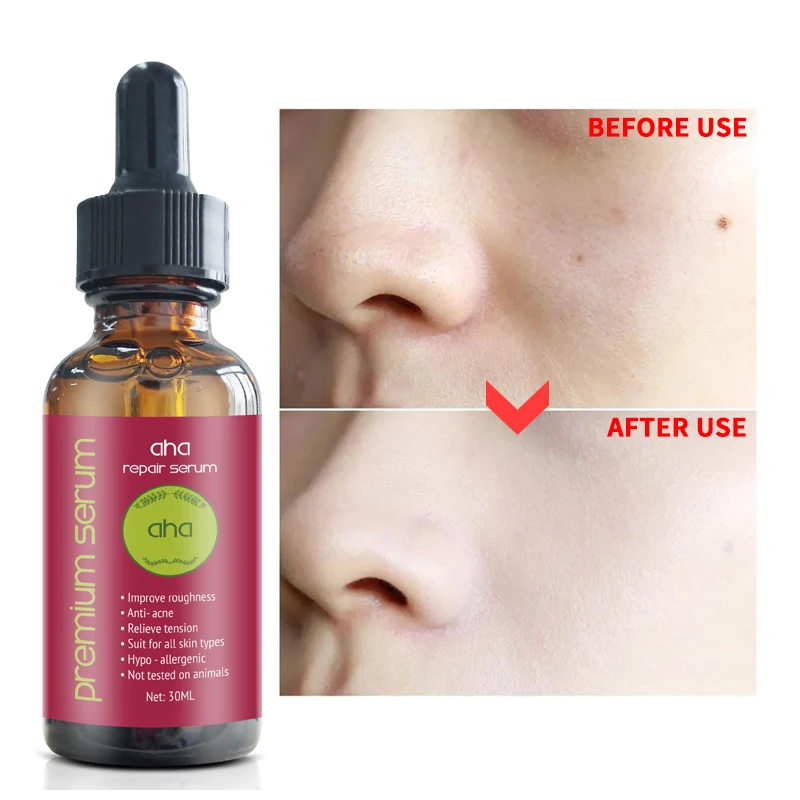 Private Label Lightening Acne Marks Smooth Exfoliate AHA Repair Serum