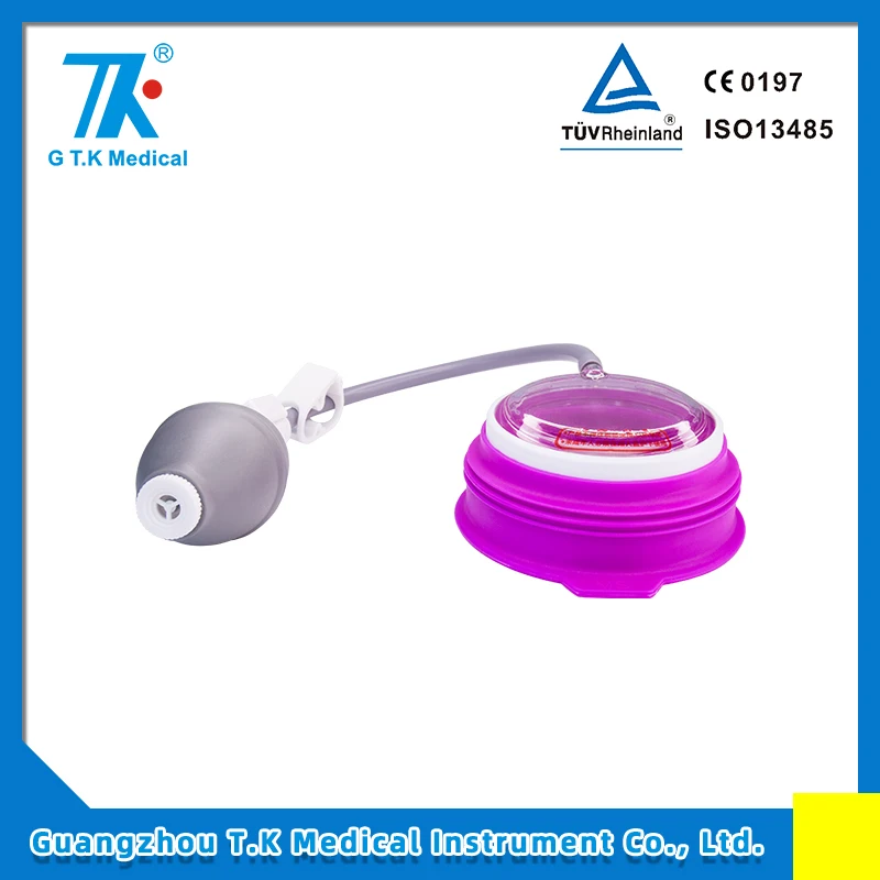 Suction Cup Vacuum Bell Non-Surgical Option to Treat Pectus Excavatum