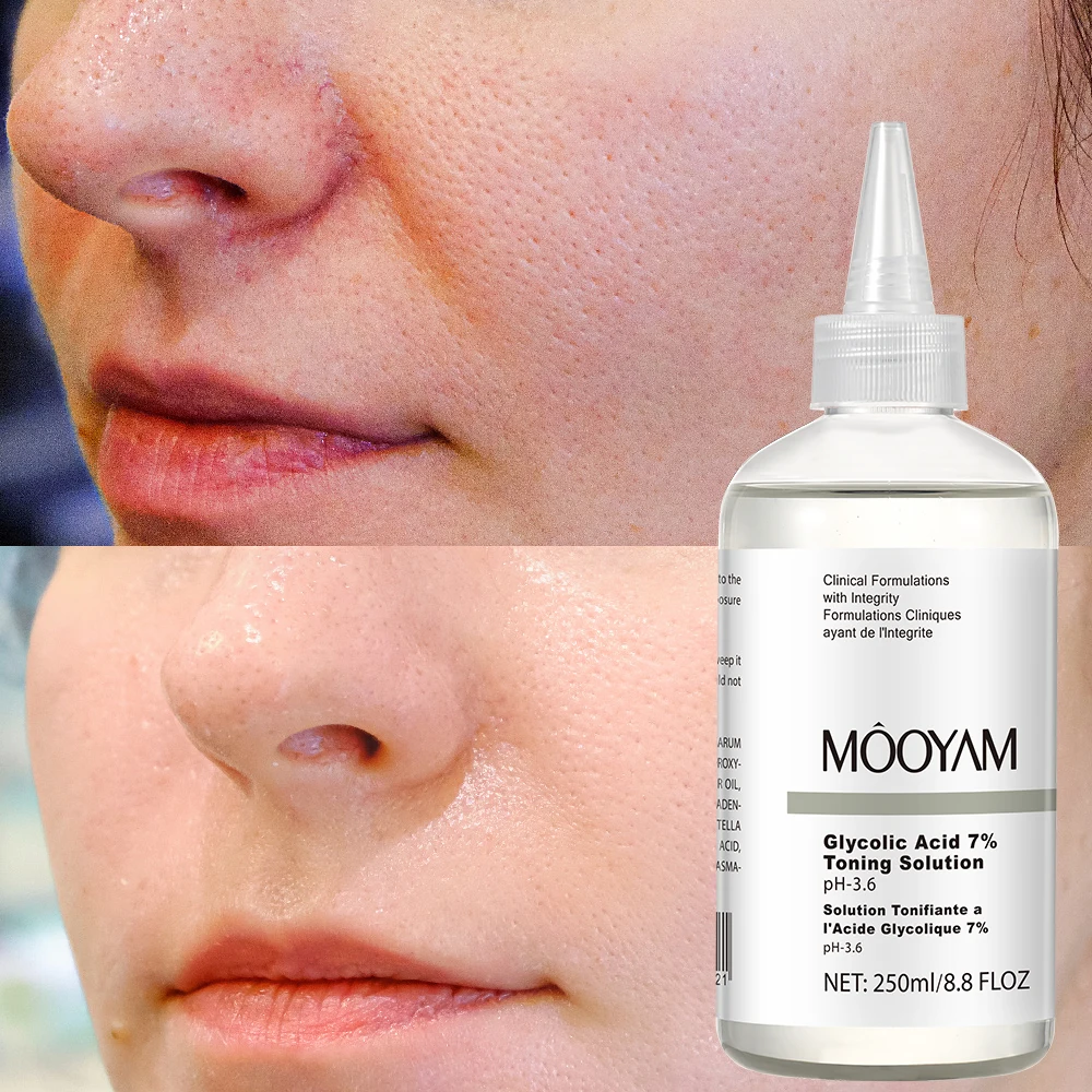 OEM ODM  7% Glycolic Acid Toning Solution Face Serum Anti Aging Remove Wrinkles Skin Care Acid Toning Facial Serum
