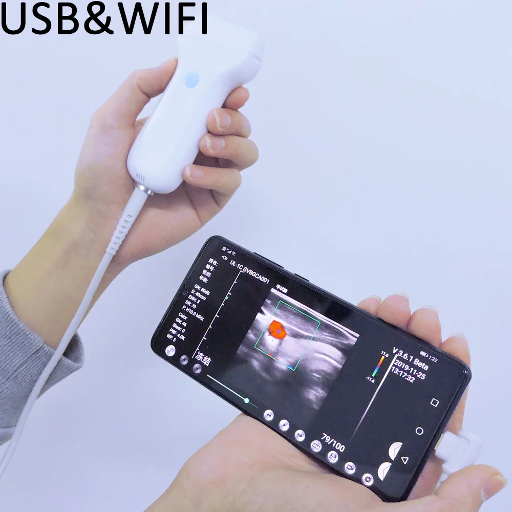  Konted Новый карманный ультразвук как USB так и Wi-Fi type-C с ультразвуковым зондом PW