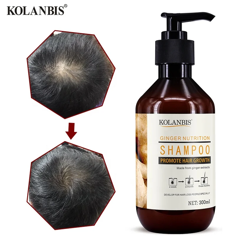 KOLANBIS оптовая продажа лучший натуральный экстракт корня имбиря шампунь для роста волос продукты против