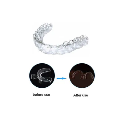 
Dental Cold Light Curing Thermoformed Gel Double layer Silicone Teeth Whitening Mouth Tray Silicone Mouth Tray 