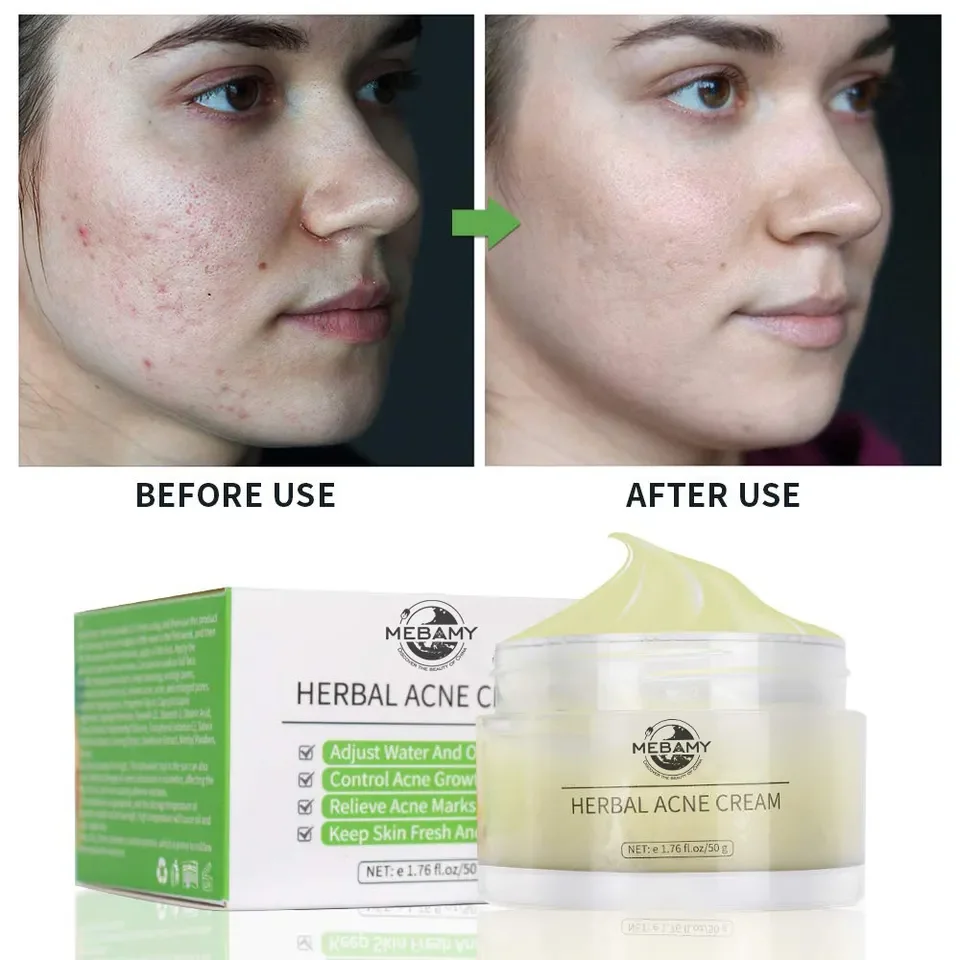 OEM Best Peptide Complex Serum Anti-Aging Collagen Cream