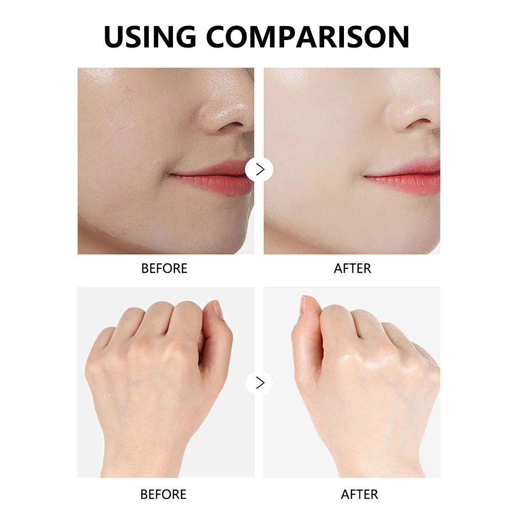 Personal Skin Care Serum Home Use Beauty Equipment Instrument Aurora Essence Water Nanometer Water And Oxygen Penetrator Set