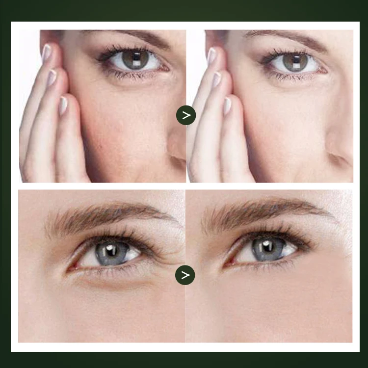 Private Label Custom Logo Korea Organic Facial Skincare Products Moisturizing Brightening Face Cosmetics Tea Tree Skin Care Set