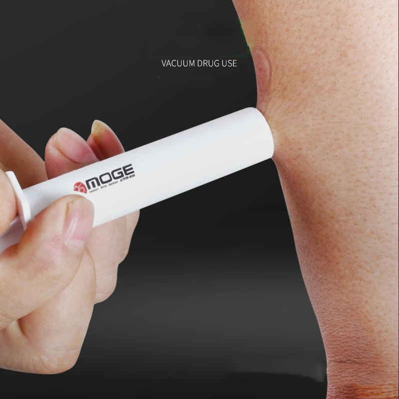 2022 hot selling outdoor first aid supplies wild External mosquito and bee stings vacuum extractor