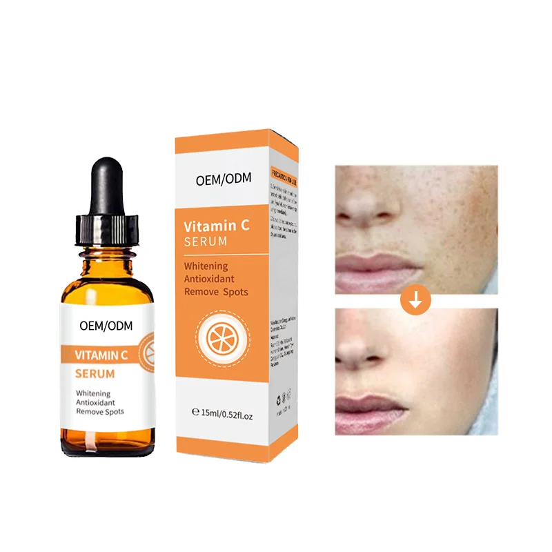 OEM Private label Skin Care Hyaluronic acid Face Serum for Face Natural Remove Spots Whitening Vitamin C Serum