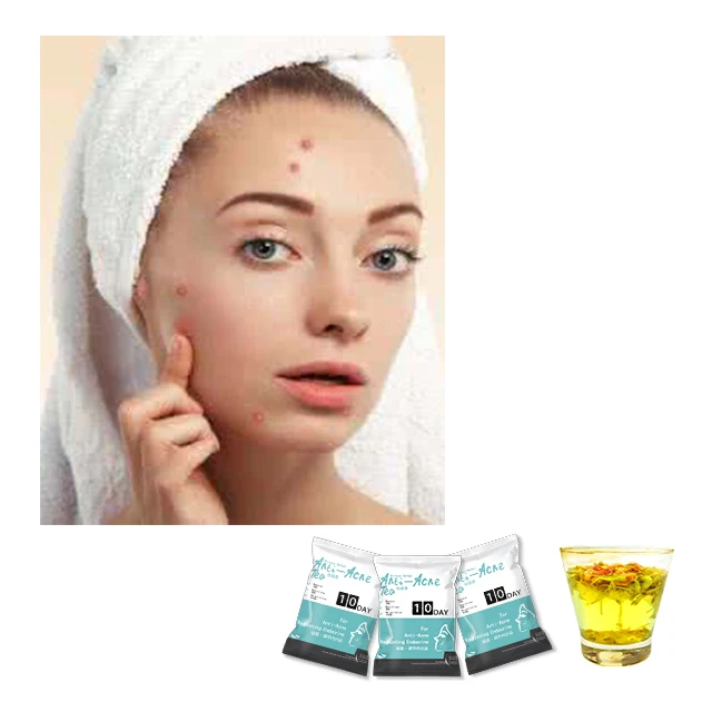 100% Natural Healthy Flower Tea Anti-constipation Anti-acne Tea Moringa Tea