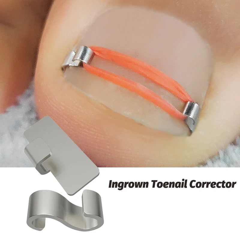 Ingrown Toenail Corrector Tools Pedicure Recover Toe Nail Treatment Professional Correction Foot Care