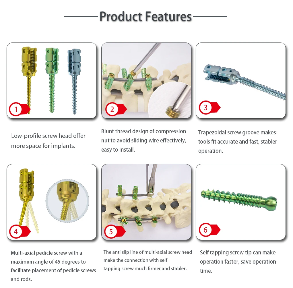 Orthopedic Implant Polyaxial Pedicle Screws Nebula System Spinal Pedicle Screw Fixation System Orthopedic Surgical Spine Implant