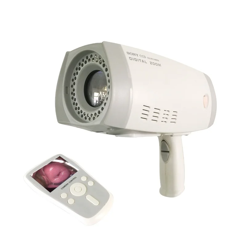 High resolution colposcope video camera colposcopy exam system digital colposcope AKX  YKD-3001
