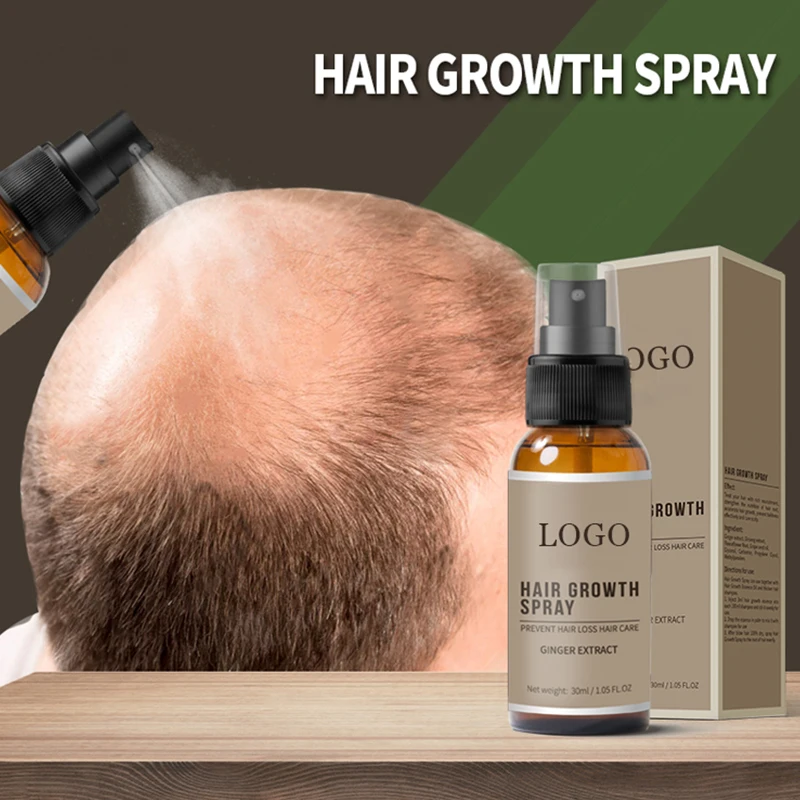 OEM New Hair Growth Spray Fast Grow Hair loss Treatment For Thinning Hair Care 30ml