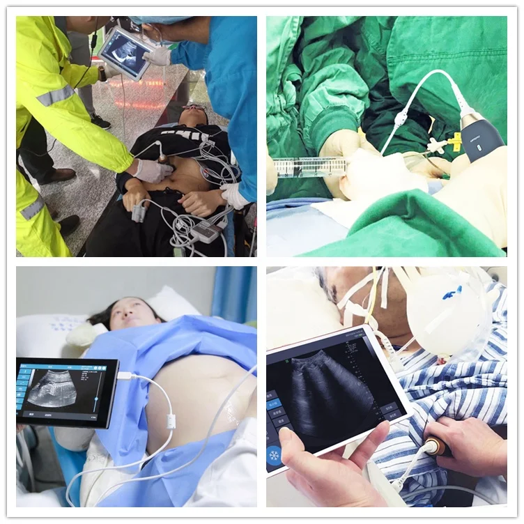 Портативный ручной мини-сканер Healson Pocket Probe M40C