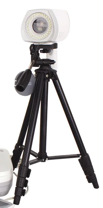 hospital professional medical Gynaecology test Digital clear images cheap price Video Colposcope