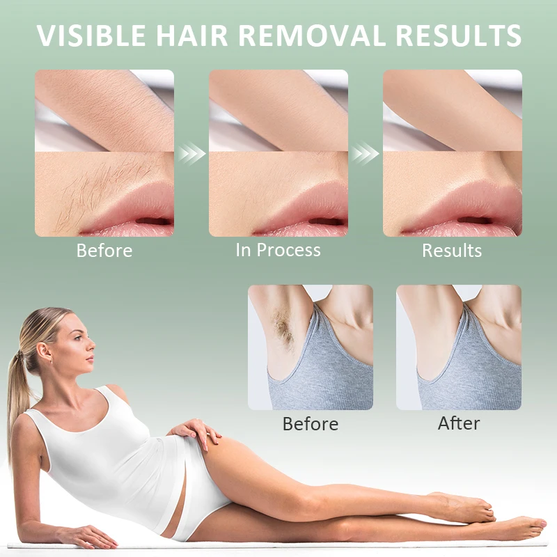 Portable Fast Flash Ipl Laser Hair Removal Device Epilator Hair Remover Machine Cooling Professional For Home Use Hair Removal