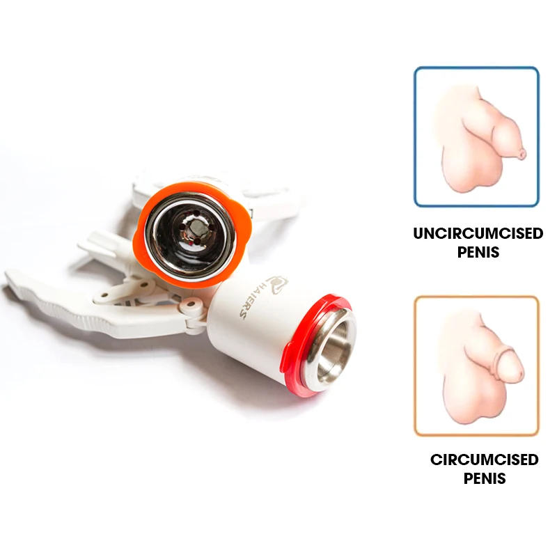 Wholesale Disposable Circumcision Staplers Made In A Reputable Factory