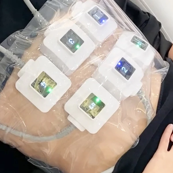 2023 Innovative Trubody Trusculpt ID Flex Fat Reduction Muscle Building EMS RF Beauty Machine