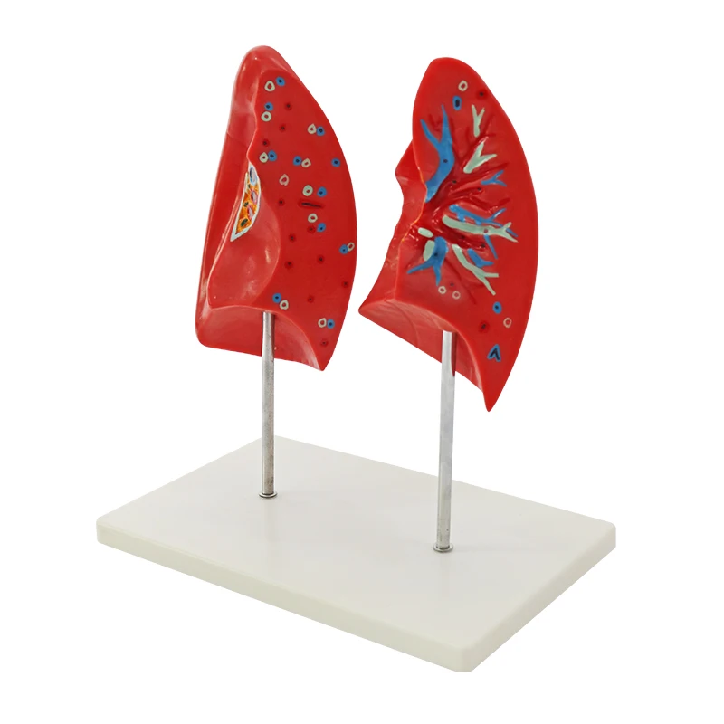 teaching biological model Left and Right Lungs model human viscera lung anatomical model
