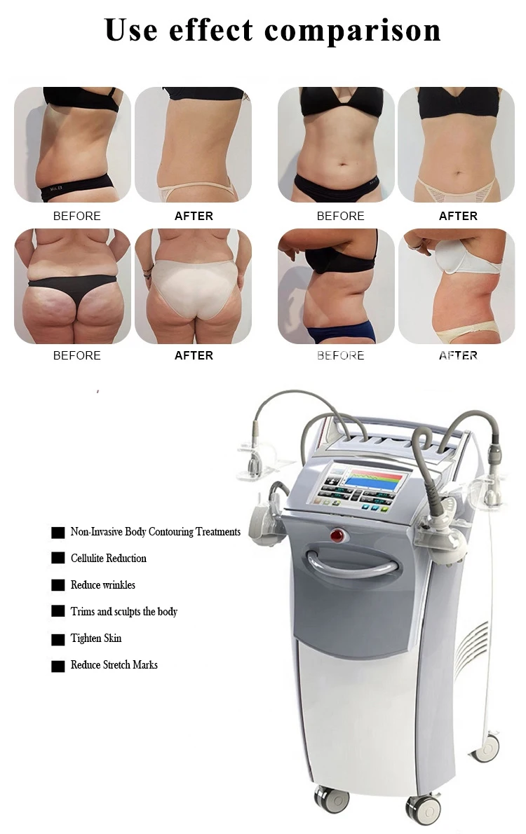 2024 China Newest Body Slimming Andtightening Device Slimming Body Shapingmachine Slimming Machine 5in1