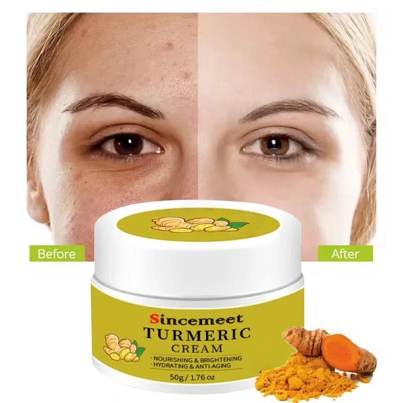 OEM Face Cream Care Removing Dark Spots Acne Treatment Anti Acne Face Vitamin C Cream Turmeric Cream