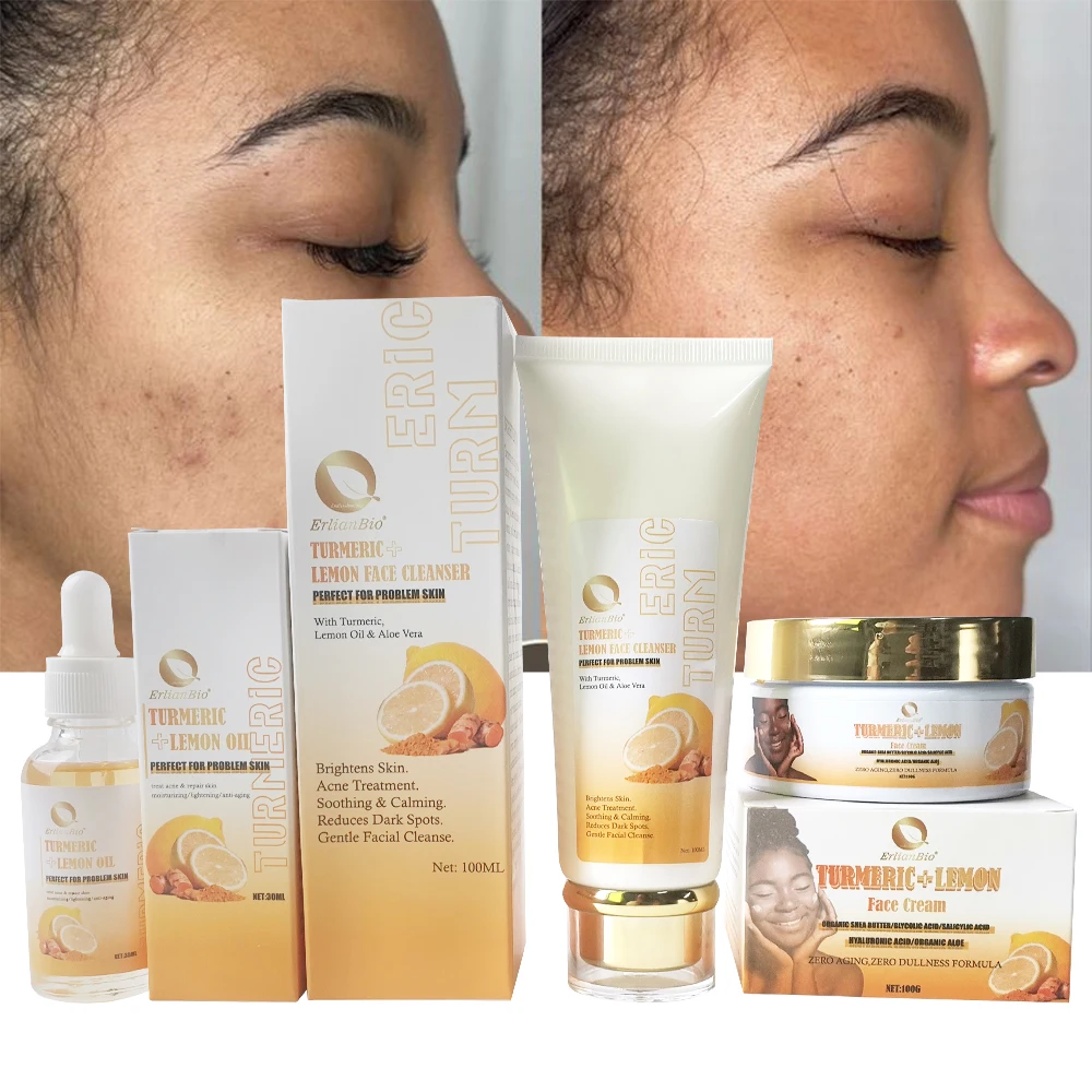Turmeric Brightening Skin Set Acne Spot Removal Facial Cleaning Moisturizing Serum Cream Face Cleansing  Skincare Set