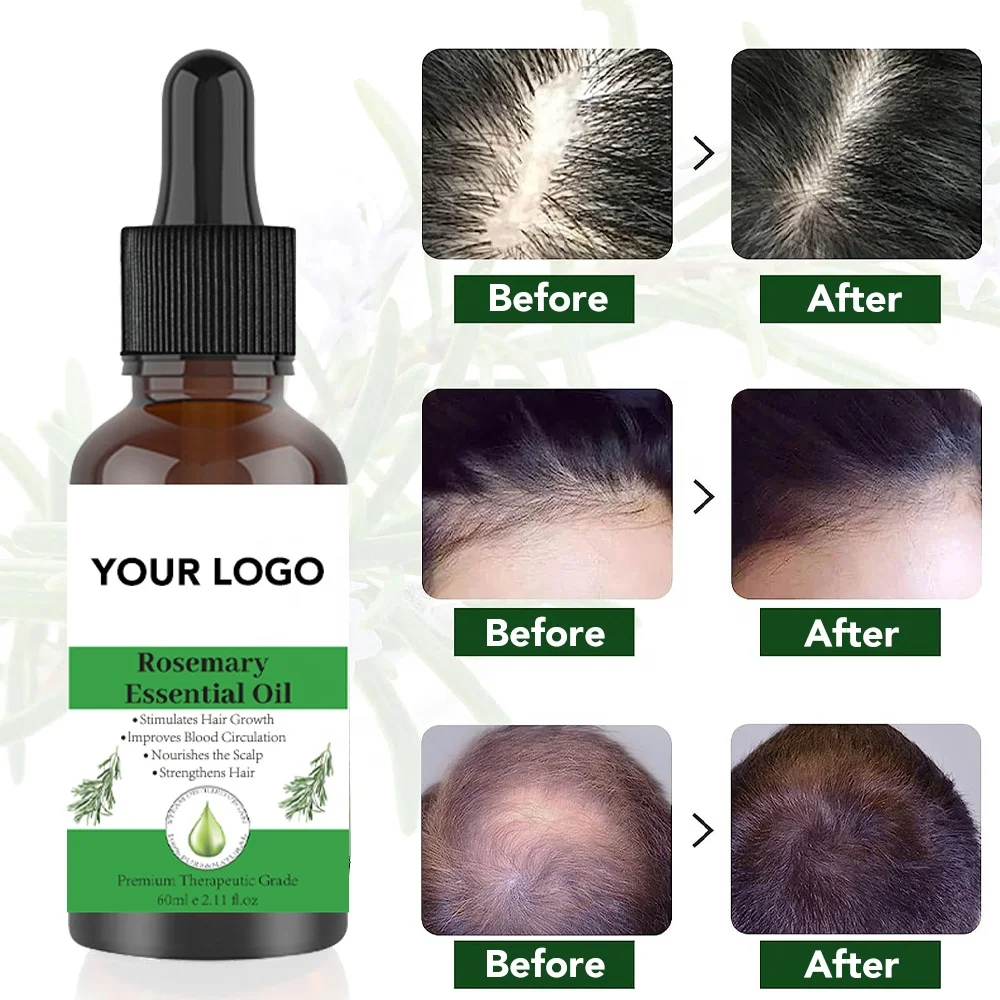 Growth For Hair Rosemary Oil Serum Repairs Luxury Hair Growth Rosemary Mint Hair Serum Oil